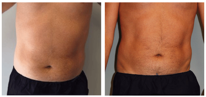 Photo Gallery | Chicagoland Aesthetics