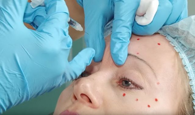 Botox clinic nearby West Loop IL
